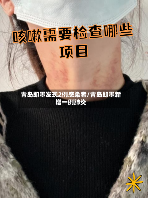 青岛即墨发现2例感染者/青岛即墨新增一例肺炎-第2张图片